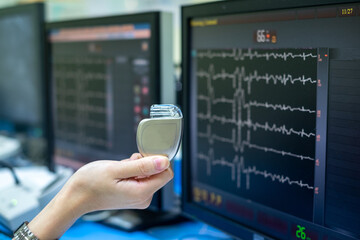Cardiac Pacemakers Industry Analysis, Size, Share, Trends, Growth, And Forecasts For 2023 – 2032