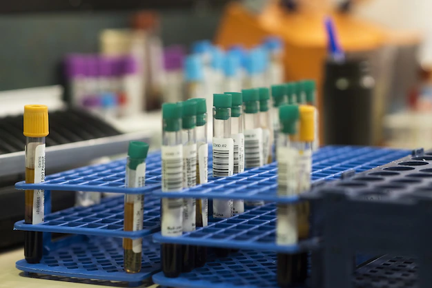 Global Pharma Microbiology Testing Kits Market Report 2023 | Market Size, Share, Growth, Opportunities, Scope 