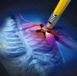 Benefits Of Choosing Exerts for Total Joint Replacement Surgery