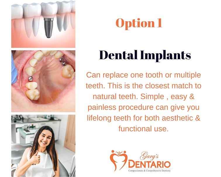Transform your look with custom teeth jewelry: from classic to contemporary