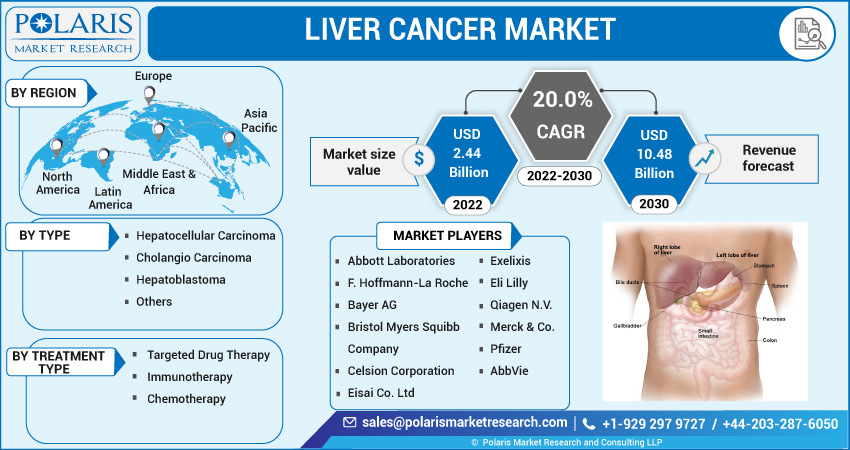 Liver Cancer Market 2023 Size, Share, Growth, Company Profiles, Trends and Forecast 2032