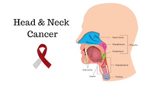 Head and Neck Cancer Market Global Projection By Key Players