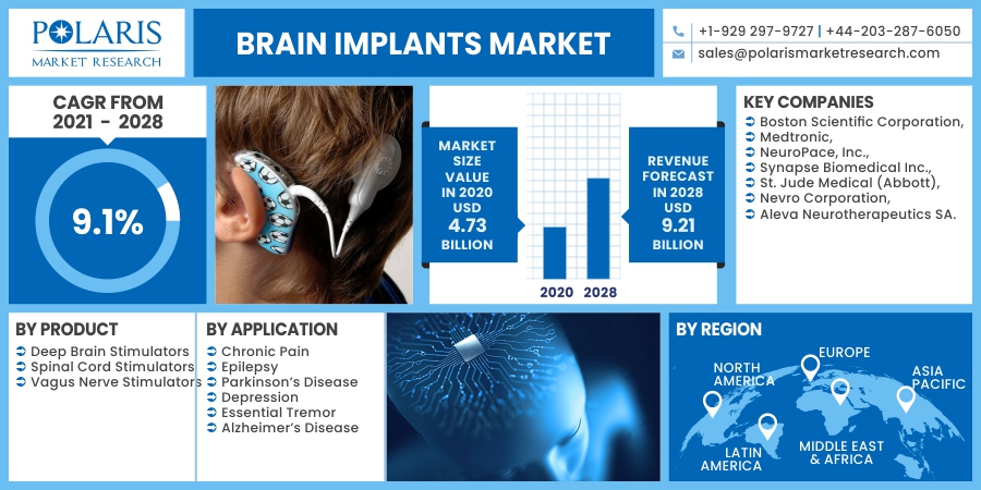 Brain Implants Market Scope 2023 Market Analysis, Investment Feasibility and Forecast To 2032