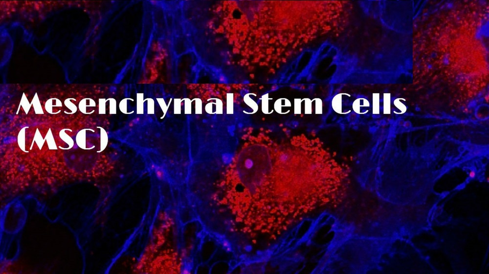 Global Mesenchymal Stem Cells Market 2022 - Top Key Players Analysis Report Till 2028