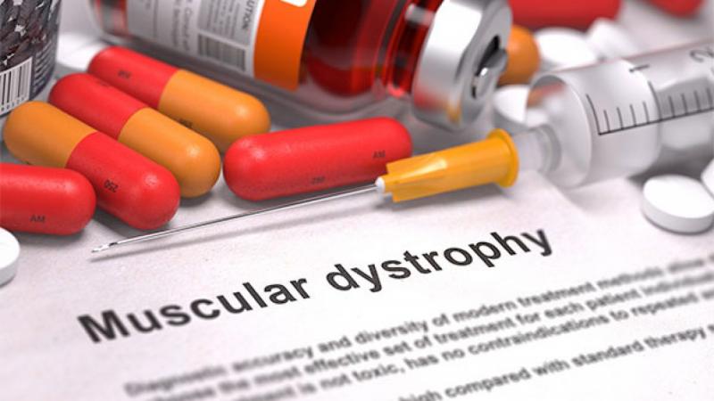 Myotonic Dystrophy Treatment Market Size, Share, Regional Overview and Global Forecast to 2028