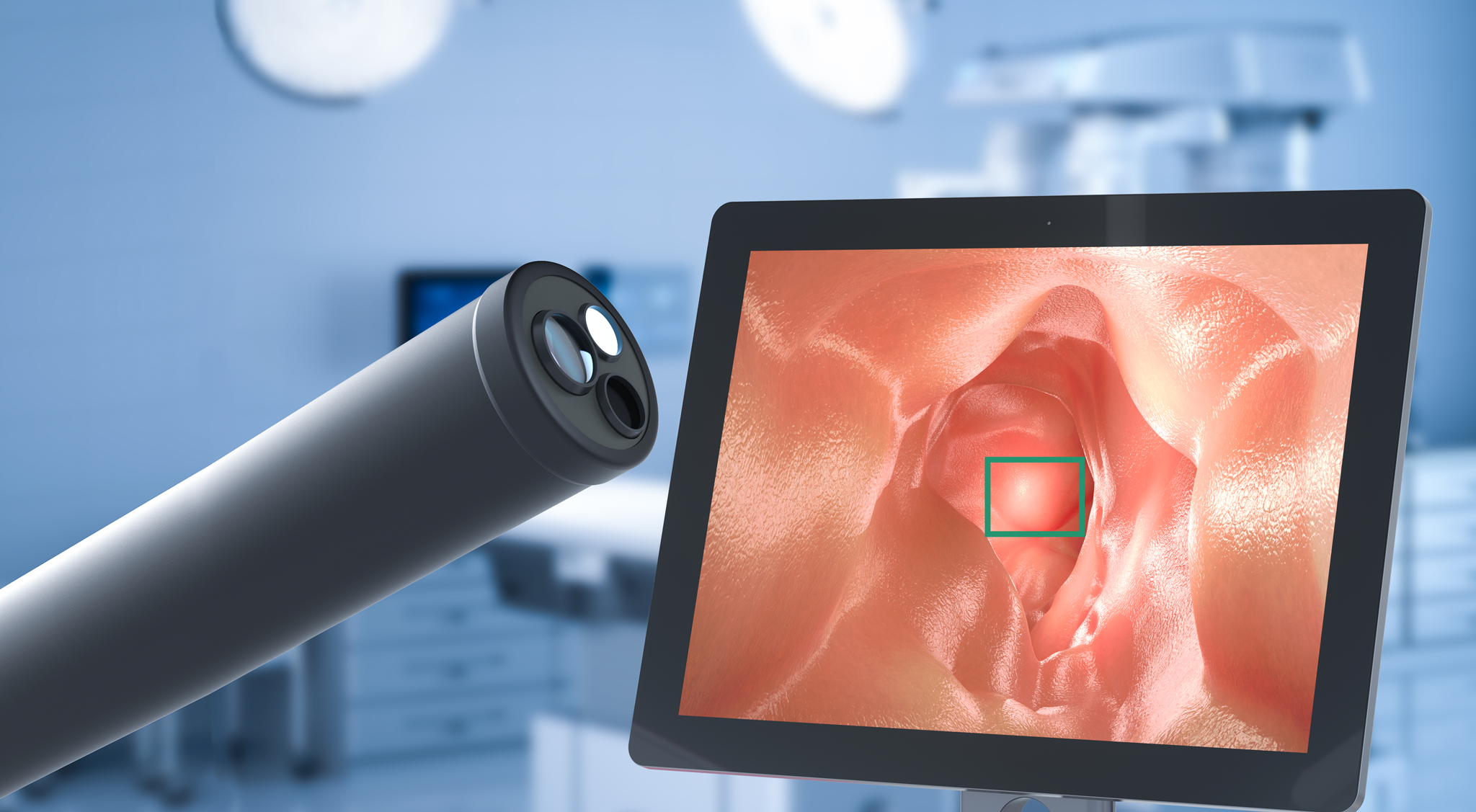 AI in Endoscopy Market Size, Share, Growth Opportunity & Global Forecast to 2030