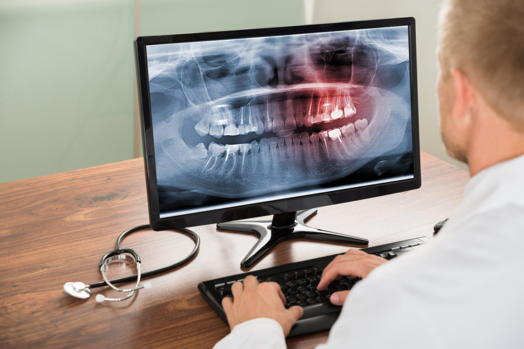 Dental Digital X-ray Market 2022 Size, Dynamics & Forecast Report 