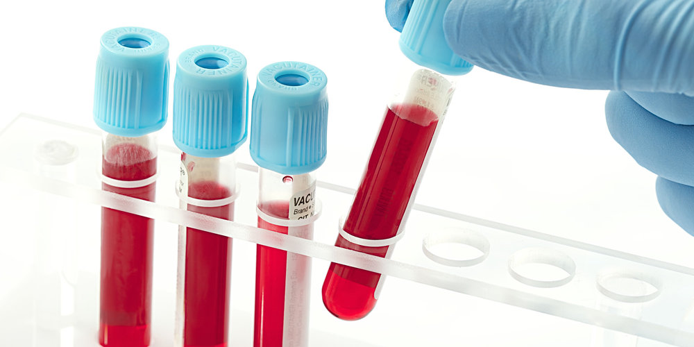 Blood Testing Market Size, Share, Growth, Opportunities and Global Forecast to 2028