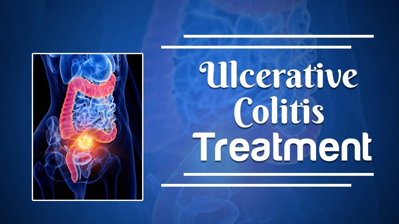 Global Ulcerative Colitis Treatment Market Report, Latest Trends, Industry Opportunity & Forecast to 2030