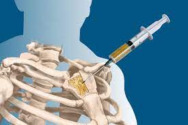 Bone Tissue Sarcoma Treatment Market Size, Share, Growth Opportunity & Global Forecast to 2030