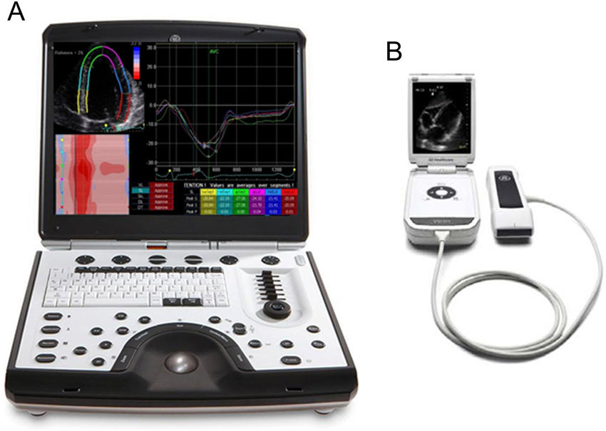 Portable Ultrasound Devices Market 2022 Size, Growth Factors & Forecast Report to 2028