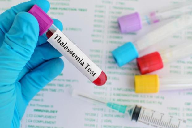 Global Beta Thalassemia Testing Market 2022 - Top Key Players Analysis Report Till 2030