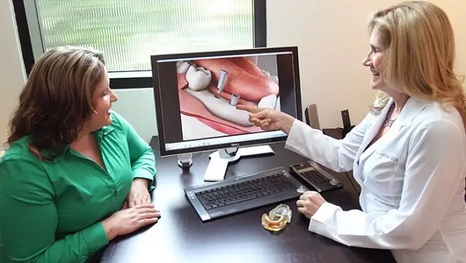What is the Cost of Dental Implants in India? - The Dental Roots