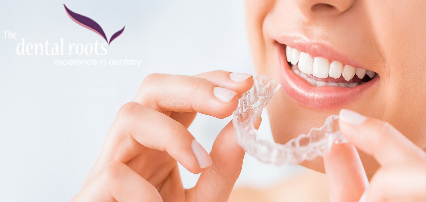 Clear Aligners India: Perfect Smile with The Dental Roots