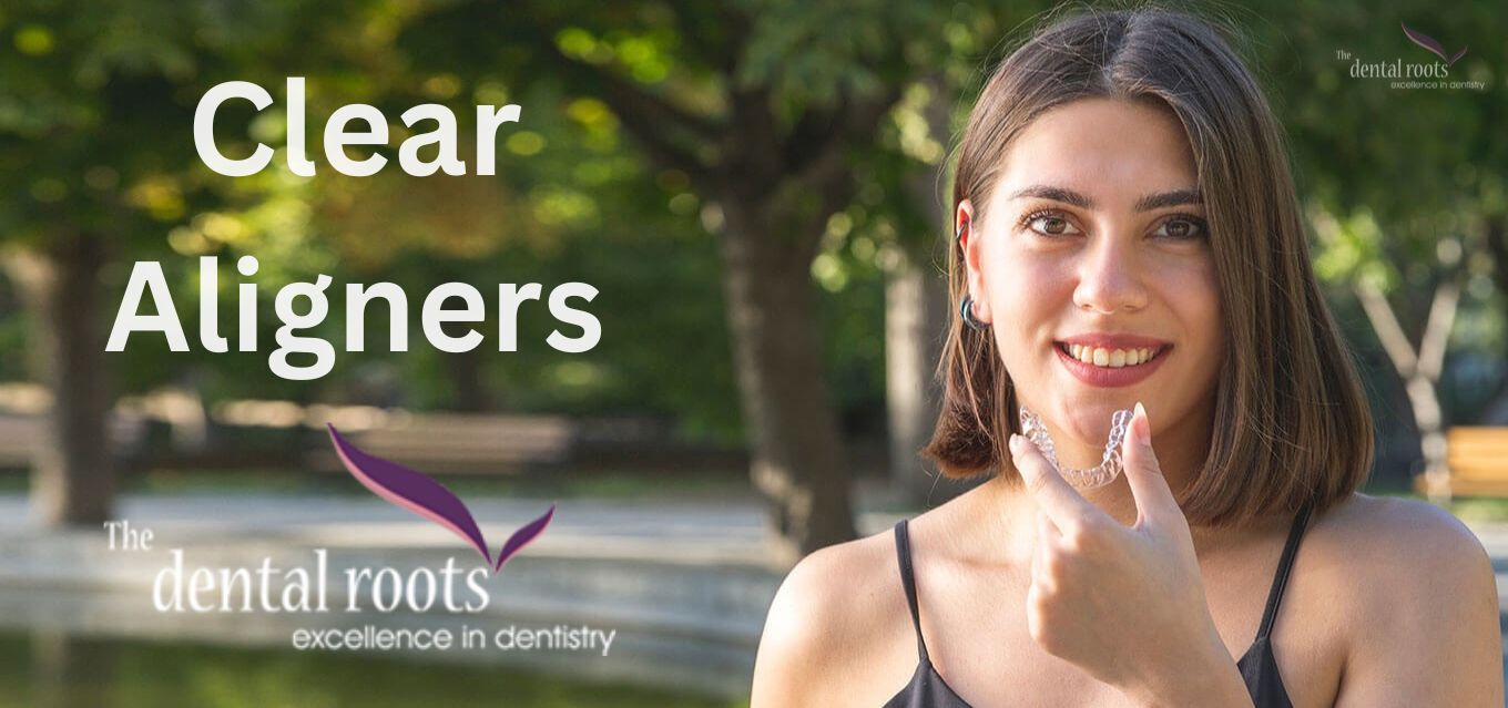 Clear Aligners India - The Dental Roots