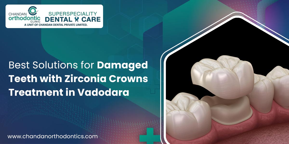 Best Solutions for Damaged Teeth with Zirconia Crowns Treatment in Vadodara