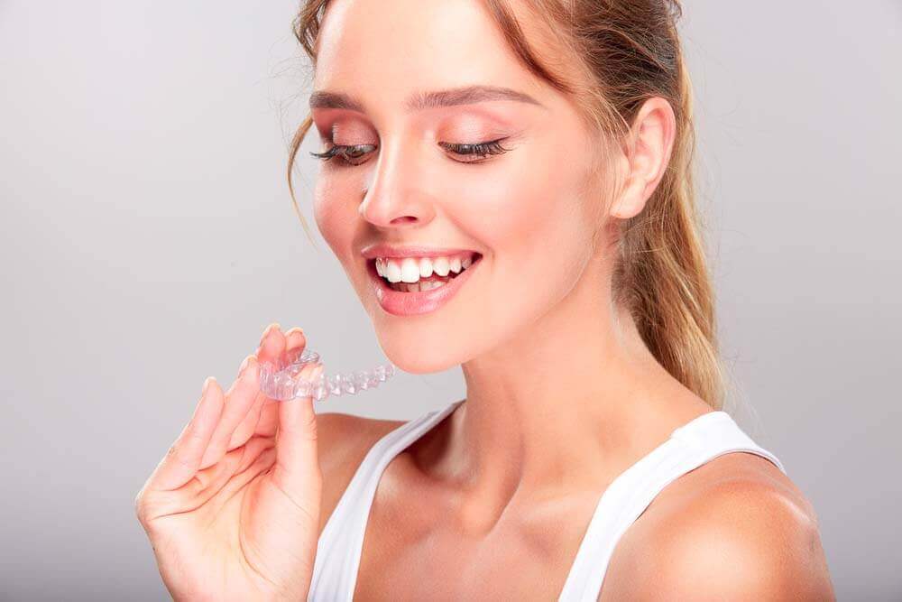 FAQs of Invisalign