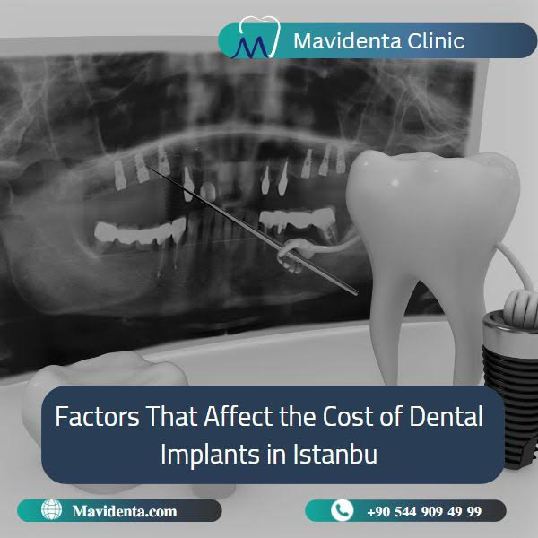 Cheapest Place To Get Full Mouth Dental Implants