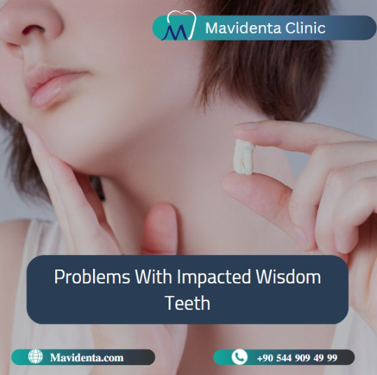Mavidenta Clinic: Excellence in Wisdom Teeth Removal in Turkey