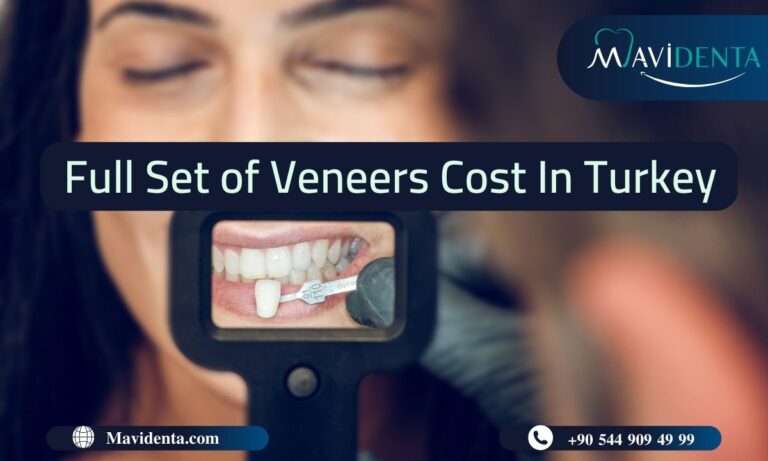 Full Set of Veneers Cost In Turkey