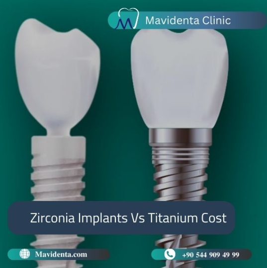 Which Is Better Zirconia Or Titanium Implants Should You Choose?