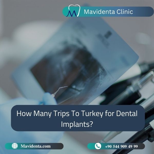 Explore Affordable Dental Holiday Packages Turkey for a Brighter Smile