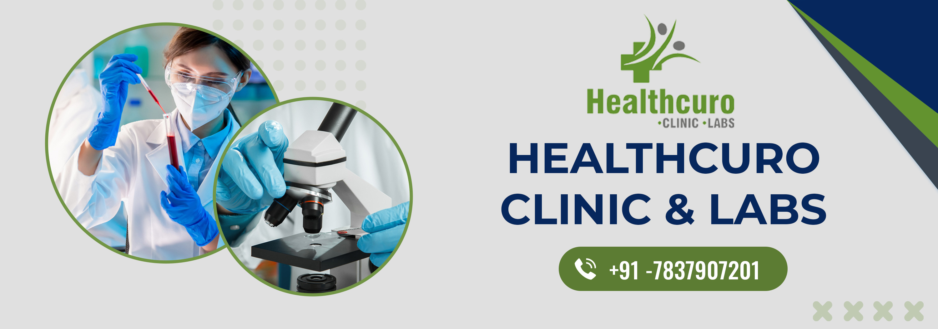 Types of Kidney Function Test in Chandigarh