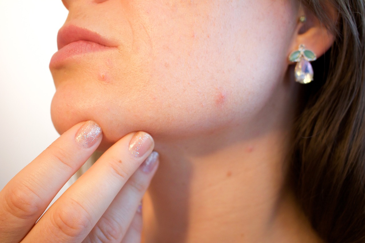 Global Scar Treatment Market Size, Share & Trends Analysis Report 2023