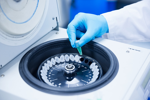 Laboratory Centrifuge Market: Key Players, Future Demand And Global Research 2023-2032