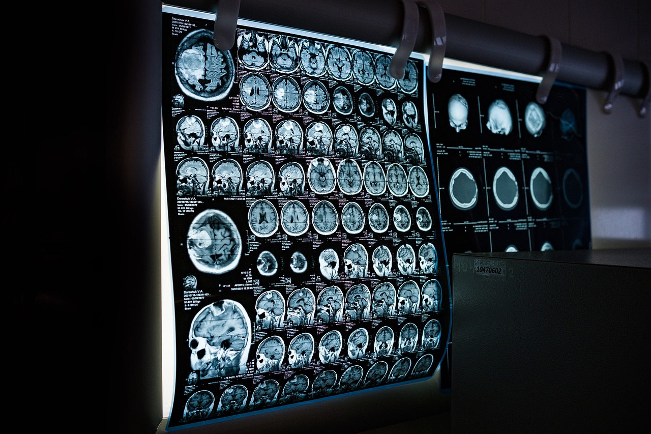 Industrial X-Ray Inspection Equipment And Imaging Software Market Share, Trends, Growth Rate, Industry Report And Forecast To 2033