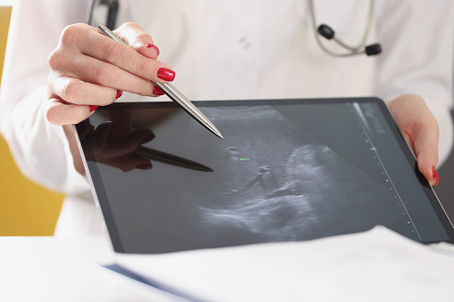 Global Assisted Reproductive Technology Market specifications, And Detailed Research Analysis Report 2023-2032