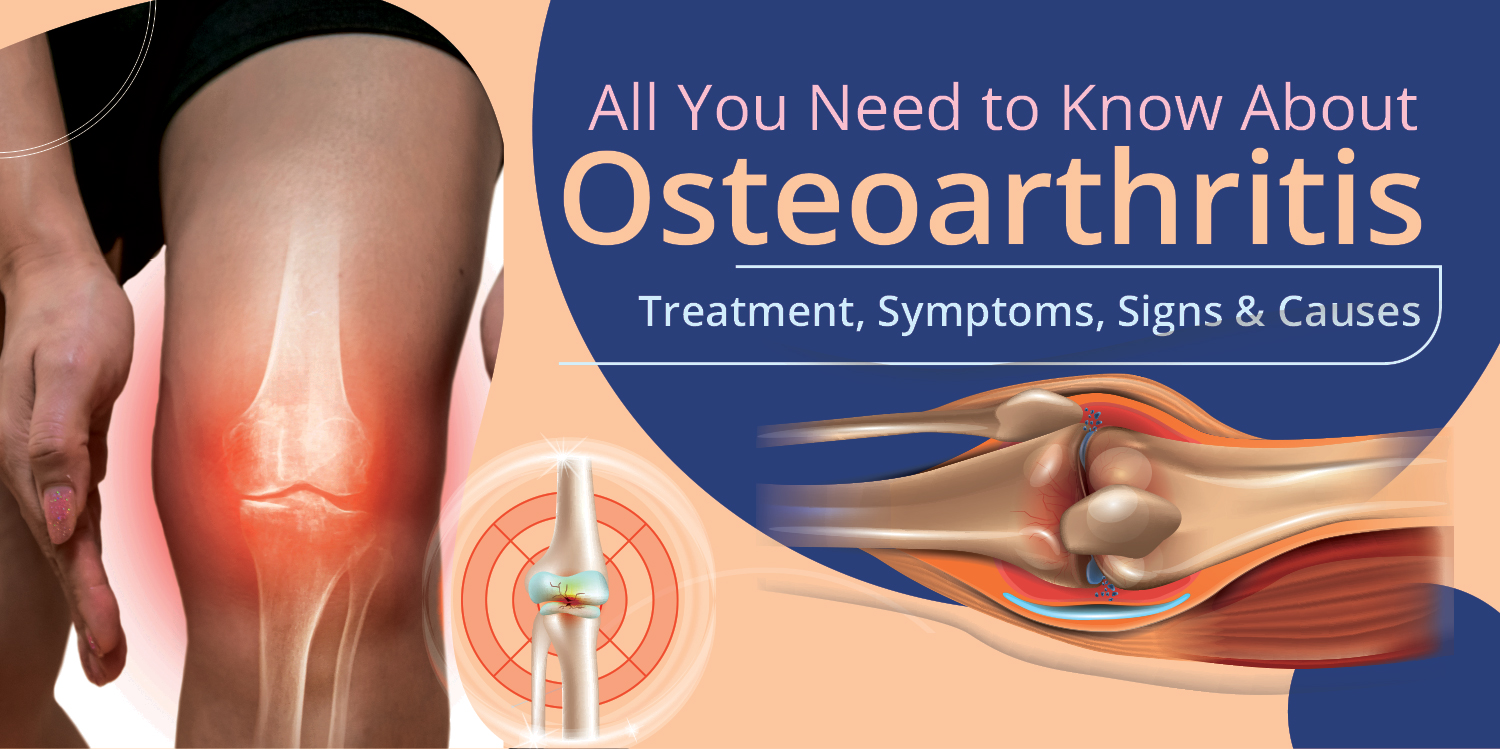 Osteoarthritis Types, Risk Factors & Prevention