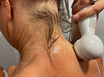 5 Effective Modern Therapies to Reduce Neck Hump Without Surgery