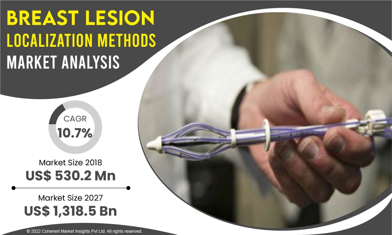 "Innovations in Breast Lesion Localization: Impact on the Market"