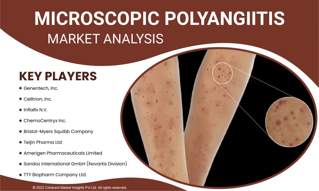 "Patient-Centric Approach in the Microscopic Polyangiitis Market: Enhancing Care and Support"