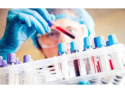 Clinical Laboratory Services Market Size to Reach $207.39 Billion By 2030