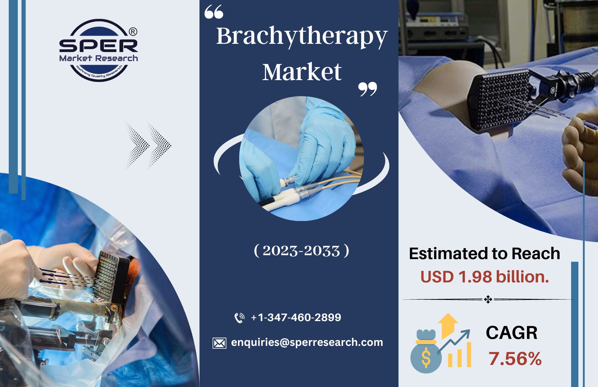 Brachytherapy Market Growth 2023- Size, Rising Trends, By COVID-19 Impact on Industry Share, Growing CAGR of 7.56%, Demand, Forecast Analysis Report 2033: SPER Market Research
