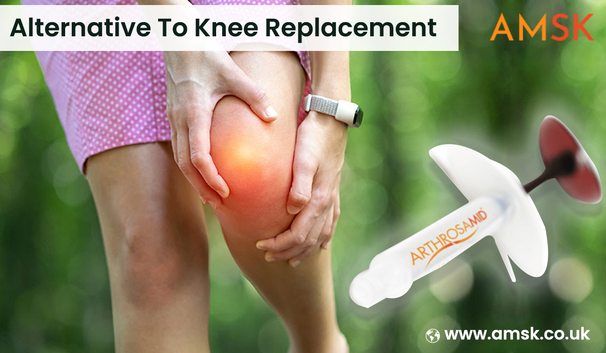 Everything You Should Know About The Arthosamid The Best Alternative To Knee Replacement