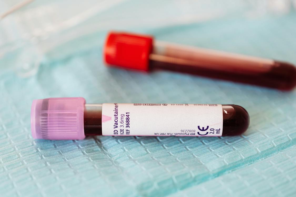 Hemostasis Analyzers Market 2024 - By Analysis, Trend, Future Scope, Demand, Leading Key Players And Industry Growth Forecast Till 2033