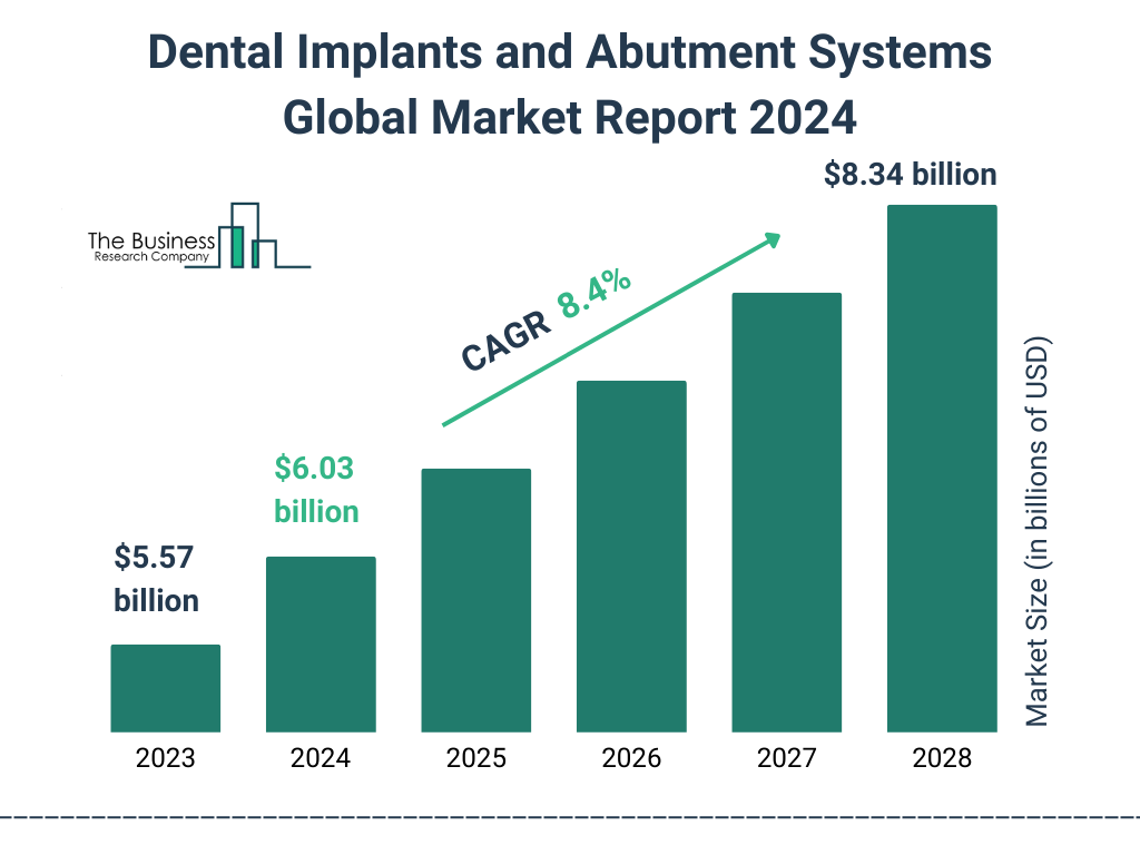 Dental Implants and Abutment Systems Market 2024 - Growth by Regional Segments, Upcoming Business Strategies, Industry Revenue And Forecast by 2033