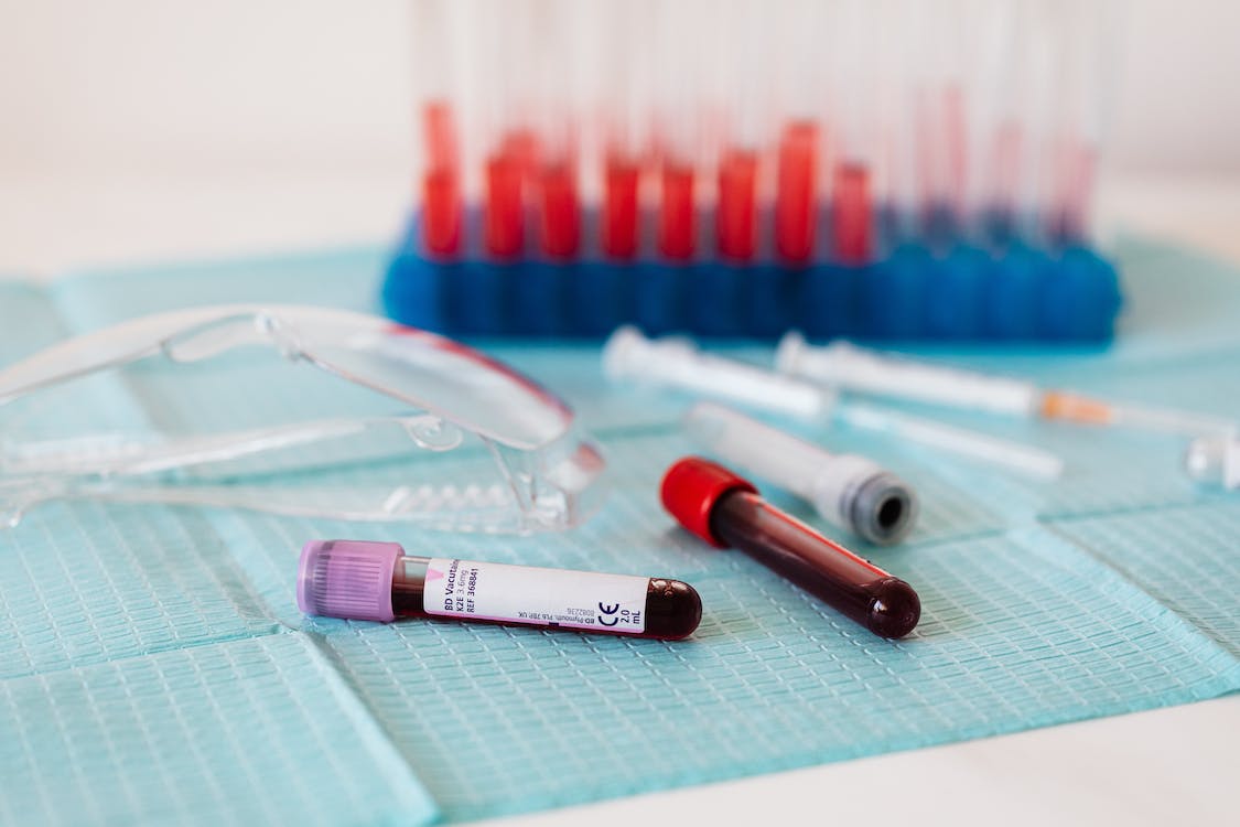 Cholesterol Test Market 2023 - By Industry Demand, Sales, Growth Rate, Key Application, Future Trends And Outlook By 2032