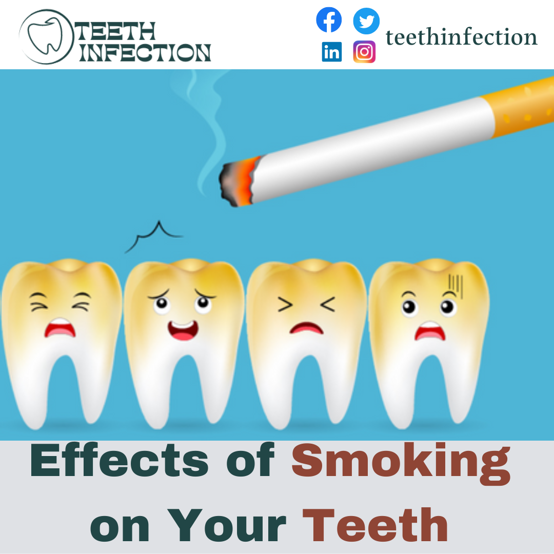 Effects of Smoking on Your Teeth