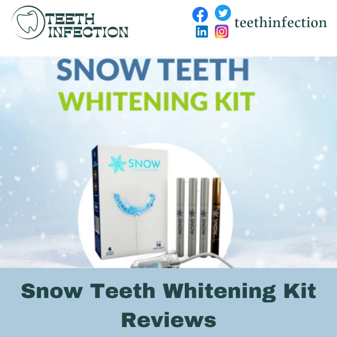 Snow Teeth Whitening Kit Reviews