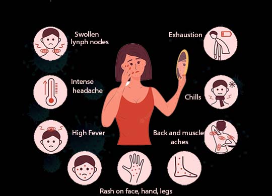  What is the monkeypox disease? how it is   conducted