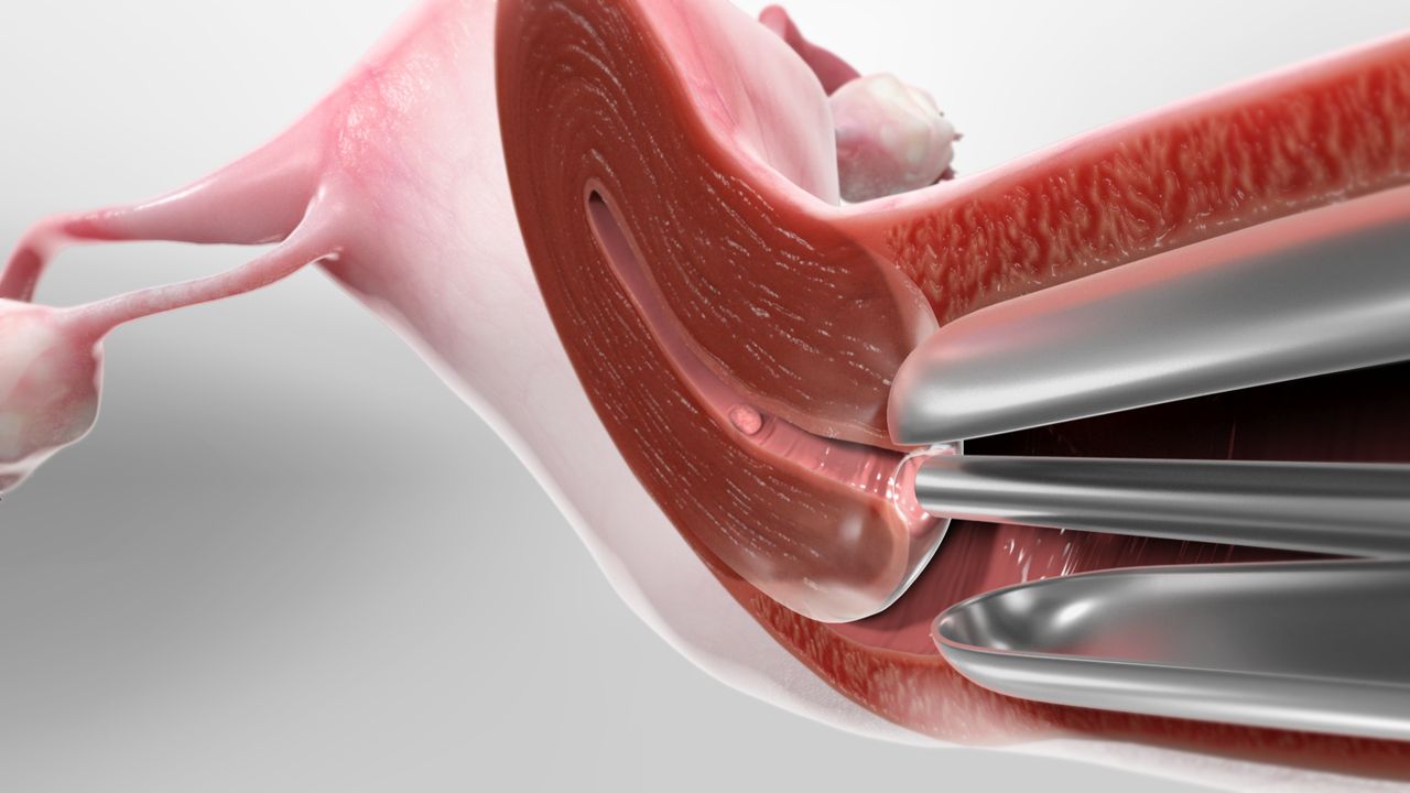 How Can Hysteroscopy Help in Diagnosing and Treating Fertility Issues?