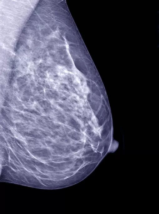  Mammogram 101: What to Expect During a Mammogram Procedure