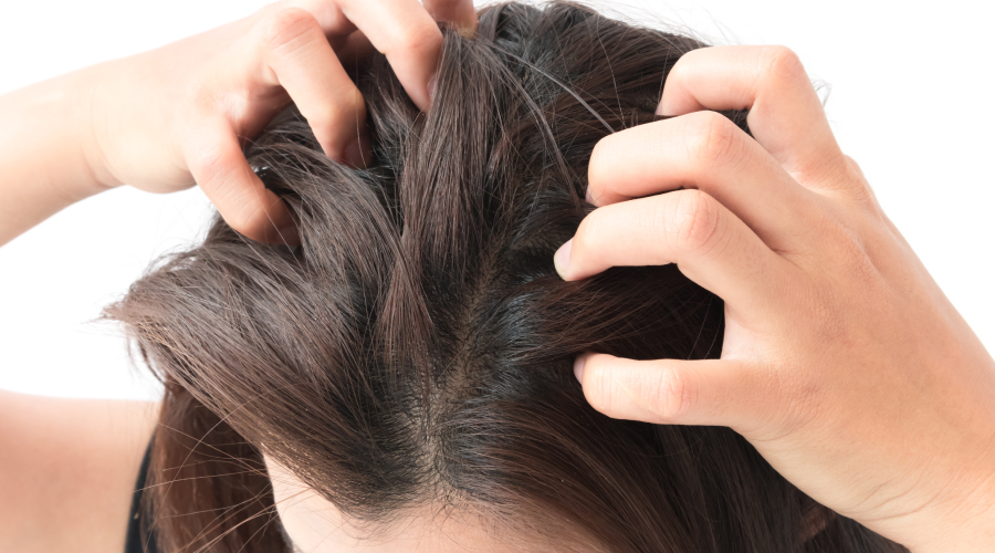   Global Scalp Care Market Is Estimated To Witness High Growth Owing To Rising Demand for Natural and Organic Products