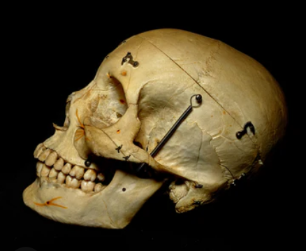 Dissected Human Skull For Sale