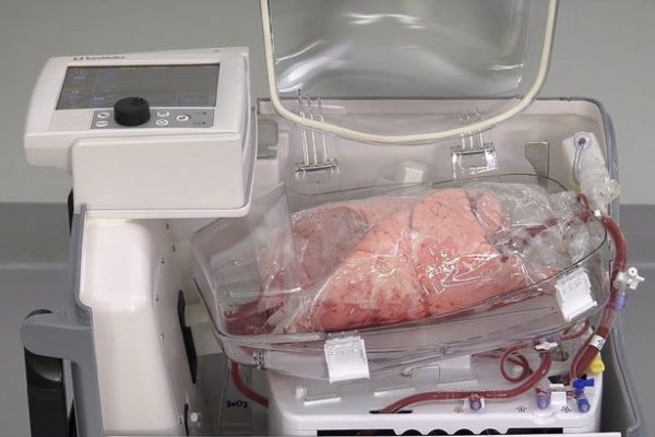 Real Human Lungs For Sale