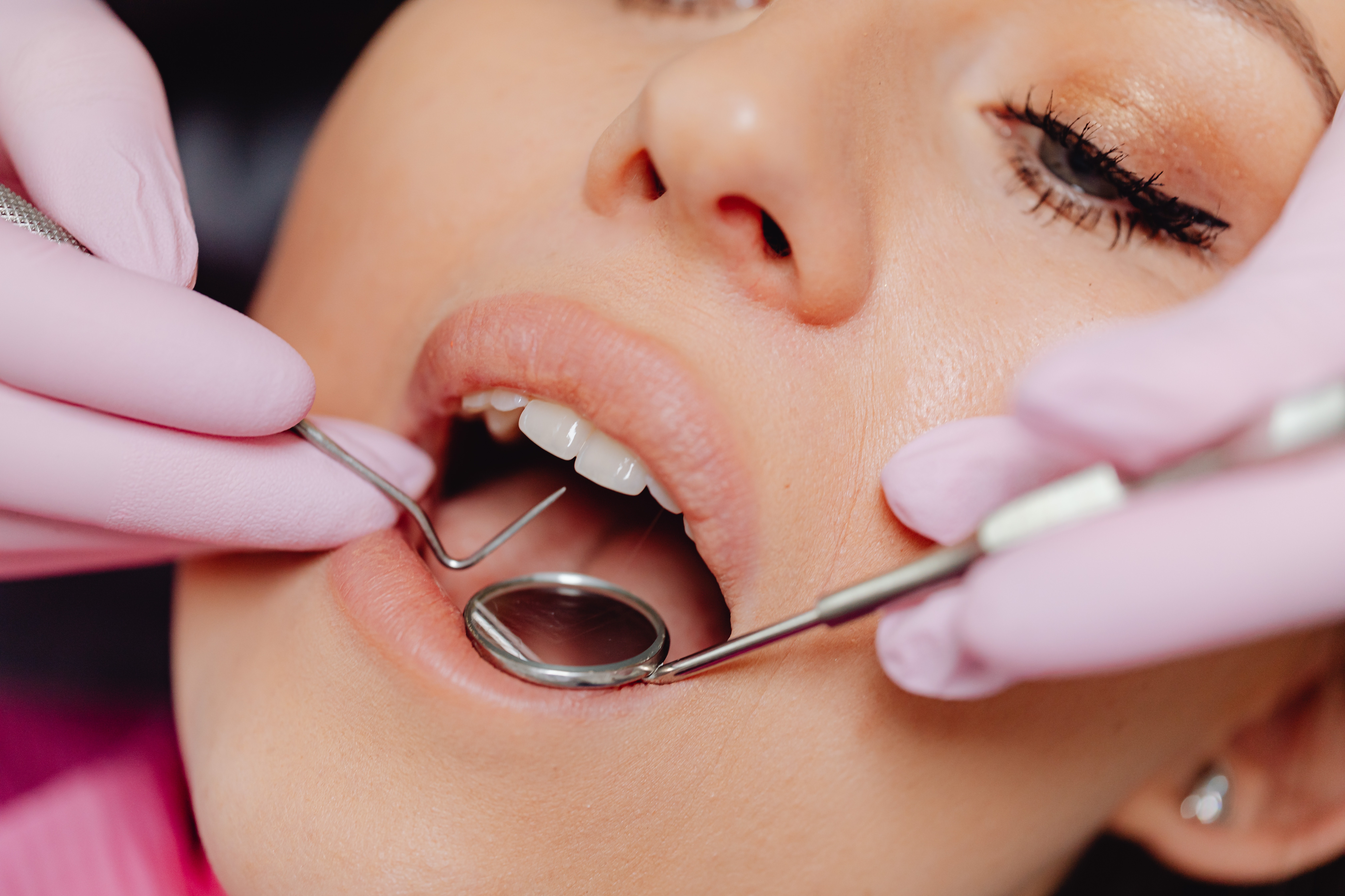 How To Prepare Your Kid For A Pediatric Dental Procedure?